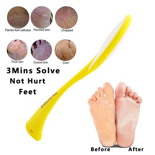 Foot File Callus Cracked Heels Hard Dead Skin Remover Feet Filer Care Tool