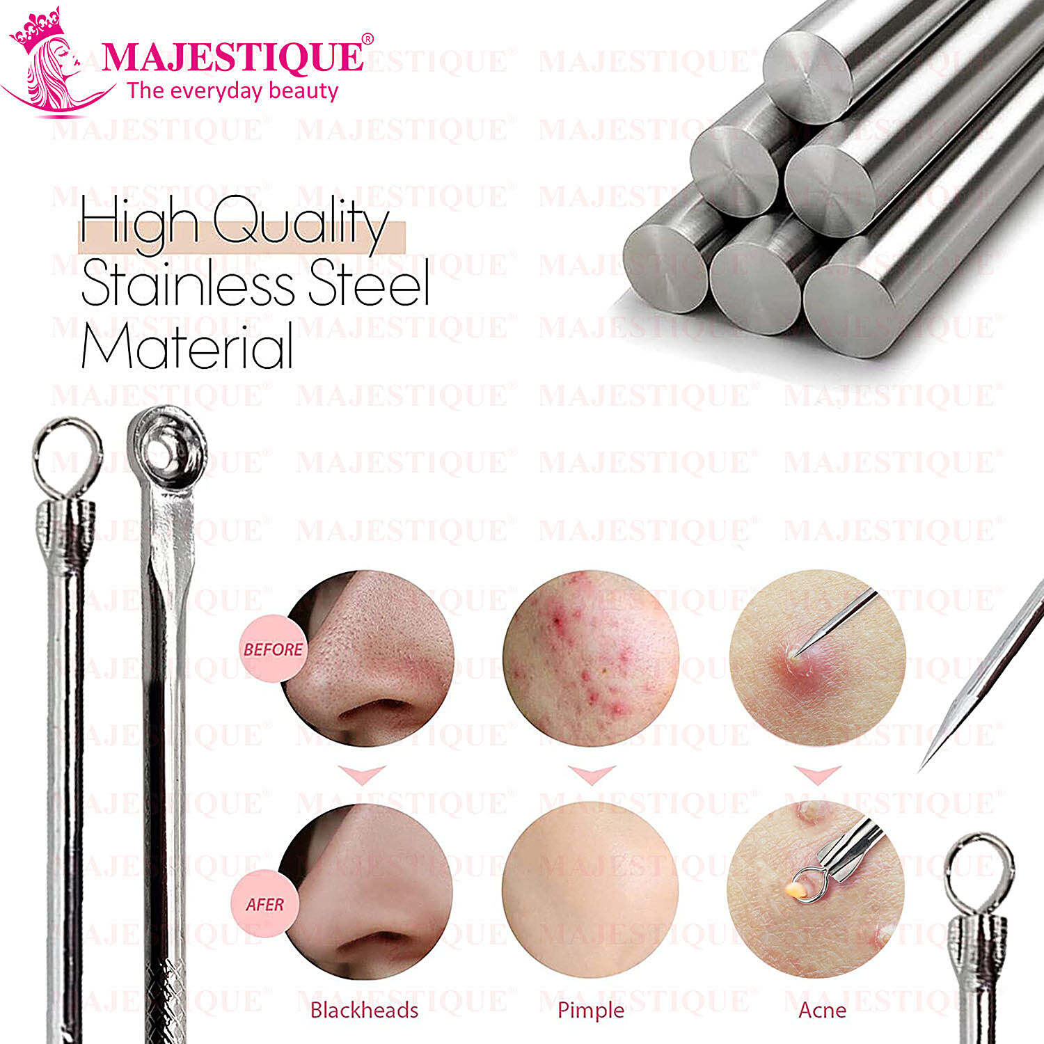 Silver MiDazzle Stainless Blackhead Extractor (Set of 4), For Personal,  Oily Skin at Rs 99/set in New Delhi